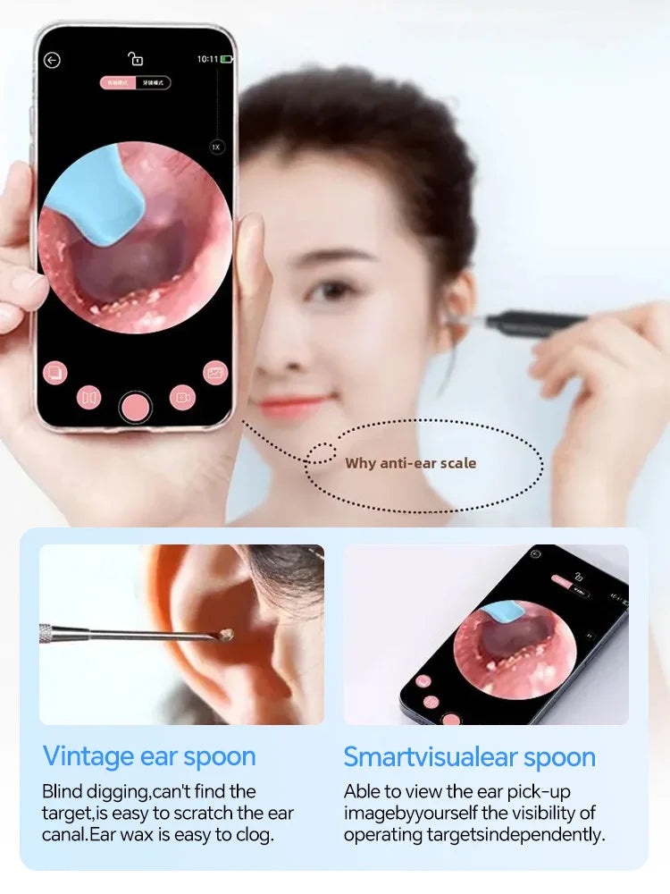 2nd Generation,Digital otoscope,Ear Wax Cleaner Camera