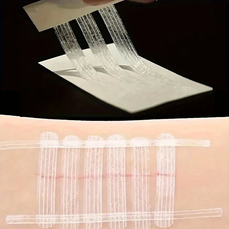 Wound Closure Tape Adhesive Sterile Medical Bandage