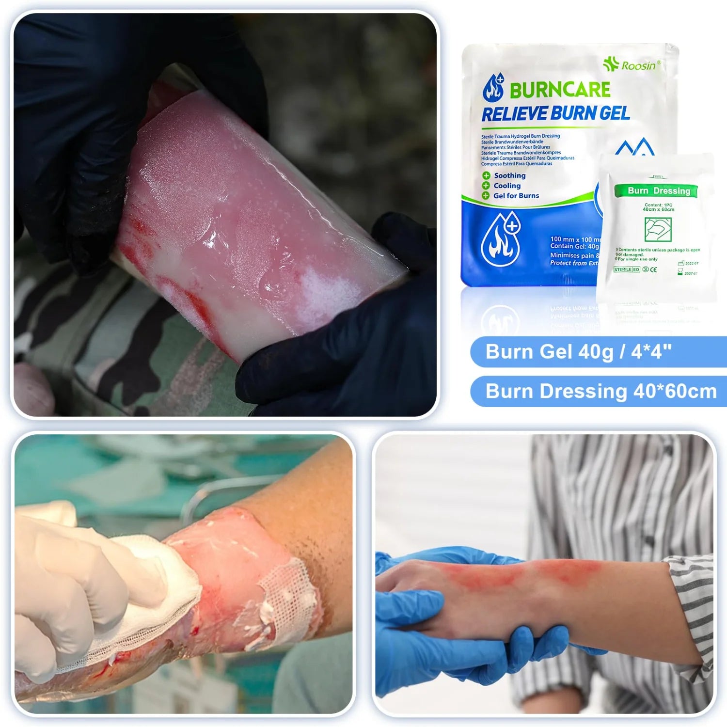 Professional Burn Care Kit with Advanced Dressings Cream
