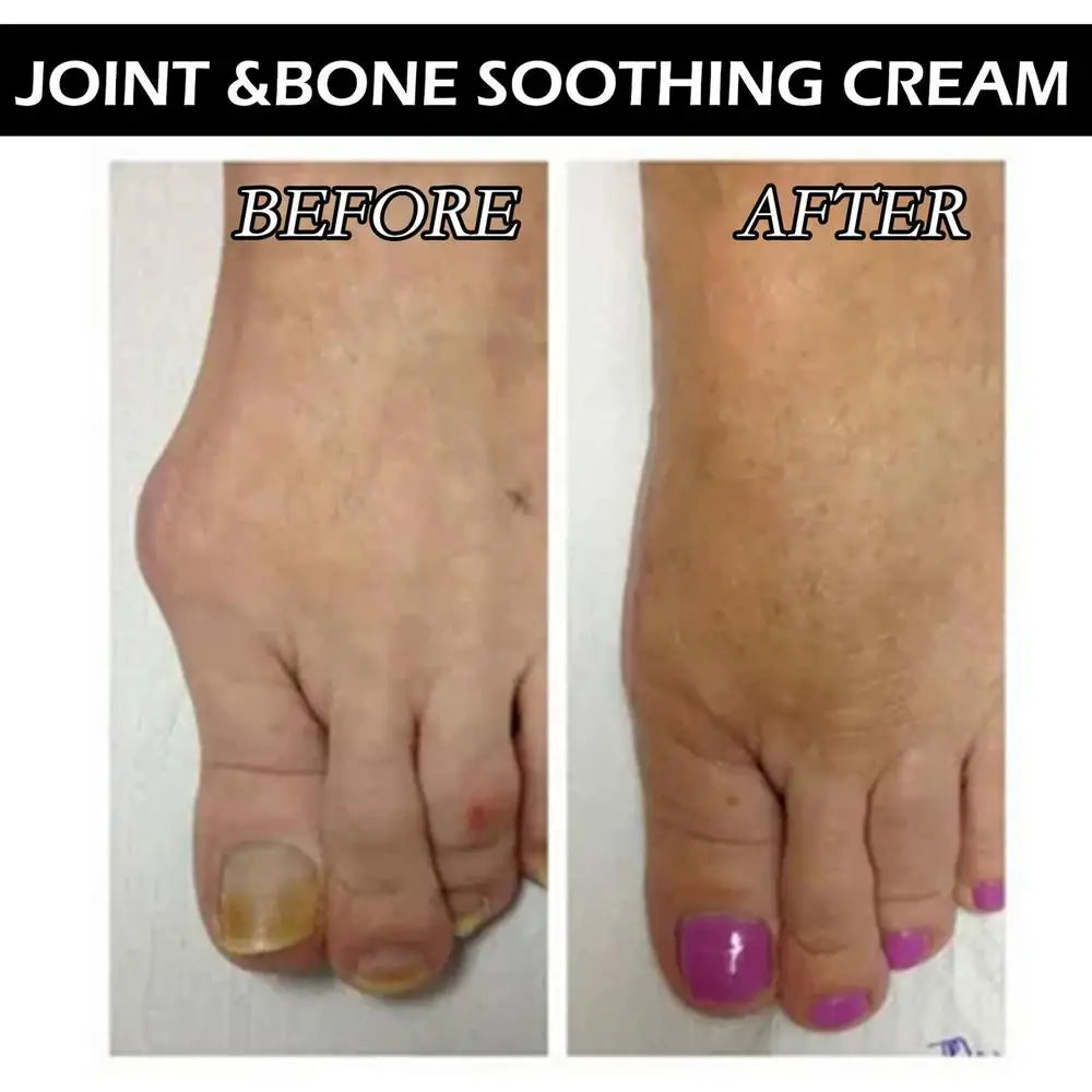 50G Joint Bone Counterpain Cream Joint Bone